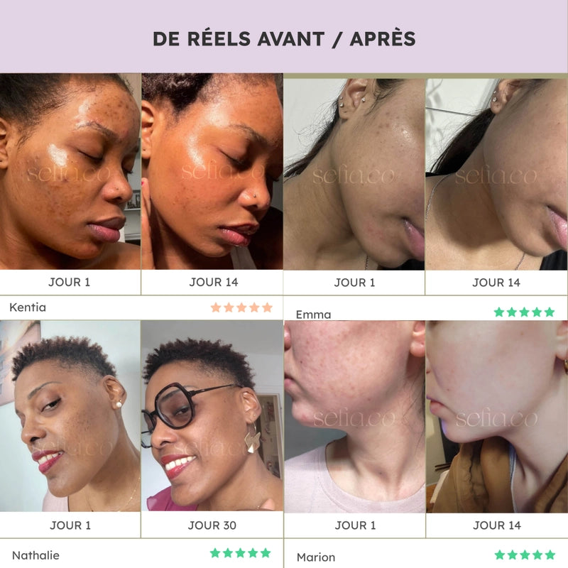 Ultra Glow - Éclat ultime pour votre peau