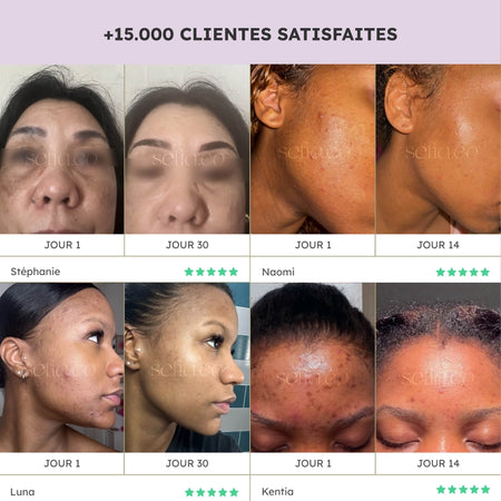 Ultra Glow - Éclat ultime pour votre peau